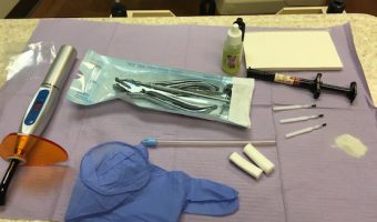 adult braces and what follows
