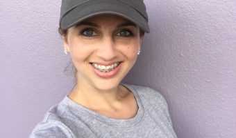 adult braces experience