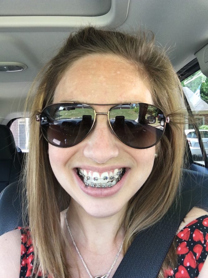 Adult Braces VIDEO Almost Done! Redhead Baby Mama Atlanta Blogger